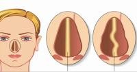 Terowongan Aroma: Rahasia Merawat Hidung agar Tetap Sehat dan Bersinar